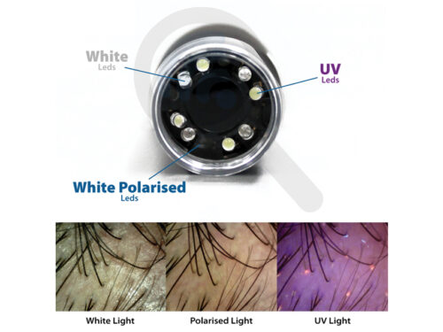 GIMA DERMATOSCOPE À LEDs POLARISÉES+UV+BLANCHES MIC Wi-Fi & USB avec logiciel "32177 – Image 6